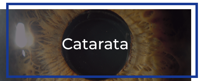 catarata.patologia