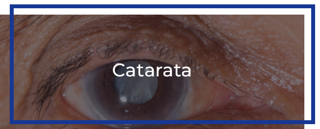 catarata2.3