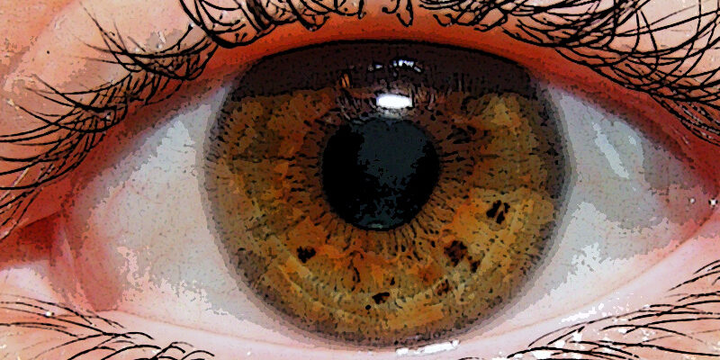 Retinosis pigmentaria2 Retinosis pigmentaria2